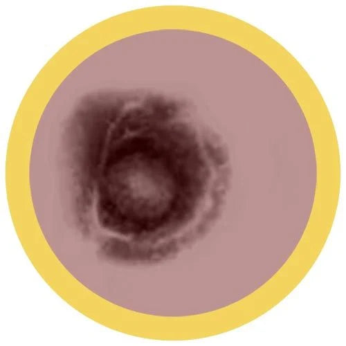 Chickenpox (Varicella-Zoster virus) Giant Microbes Plush