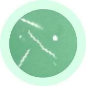 Lyme Disease (Borrelia burgdorferi) Giant Microbes Plush