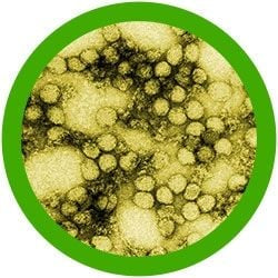 Yellow Fever (Yellow Fever Virus) Giant Microbes Plush