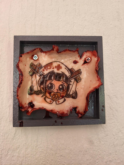 Baby Nurse Tattoo Removal Frame